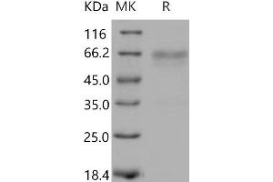 Western Blotting (WB) image for Tumor Necrosis Factor Receptor Superfamily, Member 14 (TNFRSF14) (Active) protein (His tag,Fc Tag) (ABIN7198448) (HVEM Protein (His tag,Fc Tag))