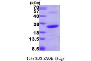 SDS-PAGE (SDS) image for NHP2 Ribonucleoprotein (NHP2) (AA 1-153) protein (His tag) (ABIN667860)