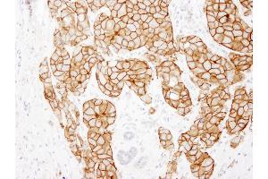 Immunohistochemistry (IHC) image for anti-Receptor tyrosine-protein kinase erbB-2 (ErbB2/Her2) (C-Term) antibody (ABIN7448962) (ErbB2/Her2 Antikörper  (C-Term))