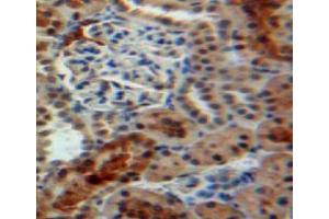 IHC-P analysis of kidney tissue, with DAB staining. (PPIB Antikörper  (AA 34-216))