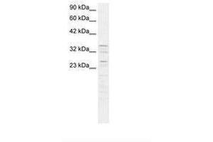 Image no. 2 for anti-Zinc Finger Protein 385A (ZNF385A) (AA 256-305) antibody (ABIN6735827) (ZNF385A Antikörper  (AA 256-305))