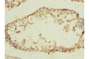 Immunohistochemistry of paraffin-embedded human testis tissue using  at dilution of 1:100 (CLEC4C Antikörper  (AA 45-213))