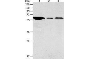Western Blotting (WB) image for anti-Adenylate Cyclase Activating Polypeptide 1 (Pituitary) Receptor Type I (ADCYAP1R1) antibody (ABIN1870813) (ADCYAP1R1 Antikörper)