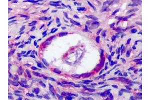 Human Ovary: Formalin-Fixed, Paraffin-Embedded (FFPE) (FSHR Antikörper  (Internal Region))