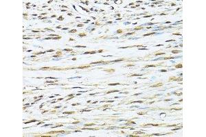 Immunohistochemistry of paraffin-embedded Human uterus using KU70 Polyclonal Antibody at dilution of 1:100 (40x lens).