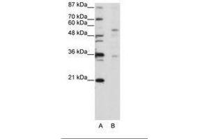 Image no. 1 for anti-Zinc Finger Protein 57 (ZFP57) (C-Term) antibody (ABIN202756) (ZFP57 Antikörper  (C-Term))