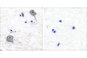Peptide - +Immunohistochemical analysis of paraffin-embedded human brain tissue using Claudin 5 antibody (#C0145). (Claudin 5 Antikörper)
