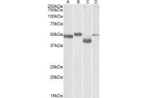 Staining of Mouse Brain (lane A), Rat Brain (lane B), Mouse Thymus (lane C) and Rat Thymus (lane D) lysates  using MEIS2 antibody at 0. (MEIS2 Antikörper  (Internal Region))