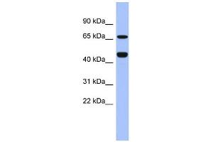 WB Suggested Anti-ZNF713 Antibody Titration:  0. (ZNF713 Antikörper  (Middle Region))