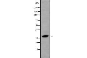 Western blot analysis of HOXB8 using LOVO whole cell lysates