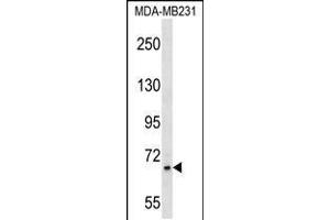 Western blot analysis in MDA-MB231 cell line lysates (35ug/lane).