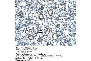 Human Lung (HOXB9 Antikörper  (N-Term))