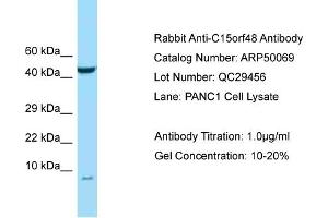 Western Blotting (WB) image for anti-Chromosome 15 Open Reading Frame 48 (C15ORF48) (N-Term) antibody (ABIN2784037)