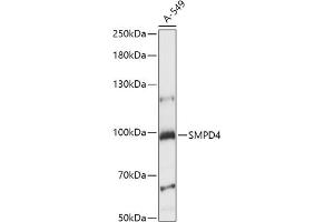 Western blot analysis of extracts of A-549 cells, using SMPD4 antibody (ABIN7270531) at 1:1000 dilution. (SMPD4 Antikörper  (AA 600-800))