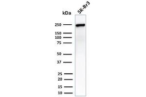 Western Blot Analysis of SK-Br3 cell lysate using CHD4 Mouse Monoclonal Antibody (3F2/4).