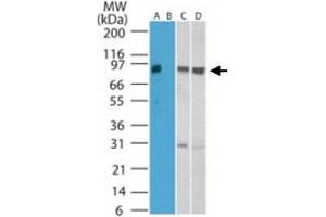 Western blot analysis of SKIL in human kidney lysate in the A) absence and B) presence of immunizing peptide, C) mouse kidney, and D) rat kidney lysate. (SKIL Antikörper  (AA 600-684))