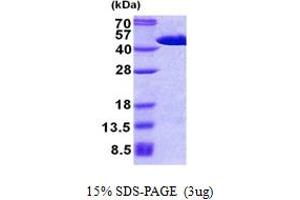 SDS-PAGE (SDS) image for Fibroblast Growth Factor (Acidic) Intracellular Binding Protein (FIBP) (AA 1-364) protein (His tag) (ABIN5853020) (FIBP Protein (AA 1-364) (His tag))