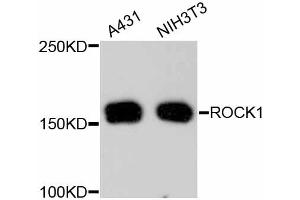 Western blot analysis of extracts of various cell lines, using ROCK1 antibody (ABIN5997107). (ROCK1 Antikörper)