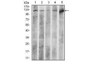 Image no. 4 for anti-ATP Citrate Lyase (ACLY) antibody (ABIN1491378) (ACLY Antikörper)