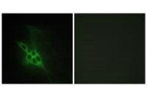 Immunofluorescence analysis of NIH/3T3 cells, using EPHB1/2/3 antibody. (EPHB1/EPHB2/EPHB3 Antikörper)