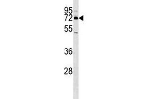 Western Blotting (WB) image for anti-Nuclear Receptor Subfamily 4, Group A, Member 2 (NR4A2) (AA 13-42) antibody (ABIN3032065)