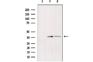 Western blot analysis of extracts from various samples, using BNIP2 Antibody. (BNIP2 Antikörper  (Internal Region))