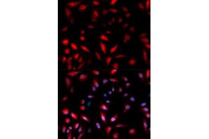 Immunofluorescence analysis of U2OS cells using Phospho-HSPB1-S82 antibody (ABIN5969898).