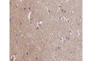 ABIN6267257 at 1/200 staining human brain tissue sections by IHC-P. (ABL1 Antikörper  (pTyr412))