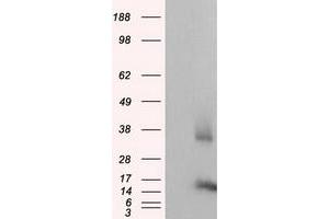 Western Blotting (WB) image for anti-CDGSH Iron Sulfur Domain 1 (CISD1) antibody (ABIN1497521)