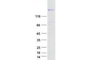 Validation with Western Blot (RAPGEF6 Protein (Myc-DYKDDDDK Tag))