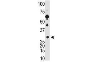 Image no. 1 for anti-Recoverin (RCVRN) (C-Term) antibody (ABIN357114) (Recoverin Antikörper  (C-Term))