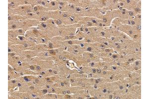 ABIN6259389 and ABIN6276155 at 1/100 staining rat brain tissue by IHC-P.