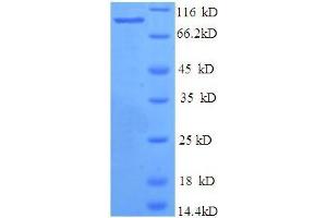 SDS-PAGE (SDS) image for Bone Morphogenetic Protein 1 (BMP1) (AA 121-986) protein (His tag) (ABIN5709141) (BMP1 Protein (AA 121-986) (His tag))
