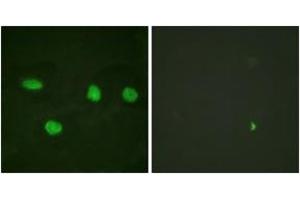 Immunofluorescence analysis of HeLa cells, using 53BP1 (Ab-6) Antibody. (TP53BP1 Antikörper  (AA 1-50))