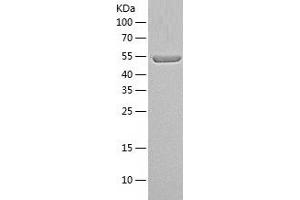 Western Blotting (WB) image for Peroxisome Proliferator-Activated Receptor gamma (PPARG) (AA 1-505) protein (His tag) (ABIN7124376)