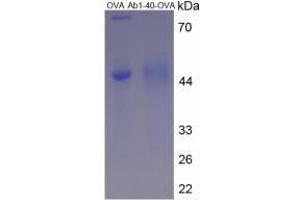 Image no. 2 for Amyloid beta 1-40 (Abeta 1-40) peptide (Ovalbumin) (ABIN5666067) (Amyloid beta 1-40 (Abeta 1-40) peptide (Ovalbumin))