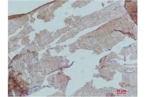 Immunohistochemistry (IHC) analysis of paraffin-embedded Mouse Skeletal Muslce Tissue using AMPKalpha1 Polyclonal Antibody. (PRKAA1 Antikörper)