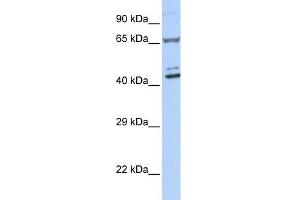 WB Suggested Anti-ZNF324 Antibody Titration:  0. (ZNF324 Antikörper  (Middle Region))