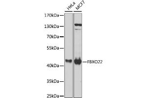 Western blot analysis of extracts of various cell lines, using FBXO22 antibody (ABIN6131311, ABIN6140516, ABIN6140517 and ABIN6224399) at 1:1000 dilution. (FBXO22 Antikörper  (AA 104-403))