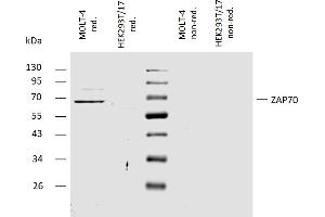 Western blotting analysis of human ZAP70 using rabbit polyclonal antibody PAb (430) on lysates of MOLT-4 cell line and HEK293T/17 cell line (ZAP70 non-expressing cell line, negative control) under non-reducing and reducing conditions. (ZAP70 Antikörper  (C-Term))