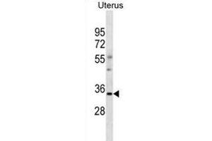 OR6S1 Antibody (C-term) (ABIN1881609 and ABIN2838743) western blot analysis in human Uterus tissue lysates (35 μg/lane). (OR6S1 Antikörper  (C-Term))