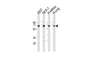 All lanes : Anti-TIEG Antibody (N-term) at 1:2000 dilution Lane 1: 293T whole cell lysates Lane 2: MCF-7 whole cell lysates Lane 3: human kidney lysates Lane 4: human lung lysates Lysates/proteins at 20 μg per lane. (KLF10/TIEG1 Antikörper  (N-Term))