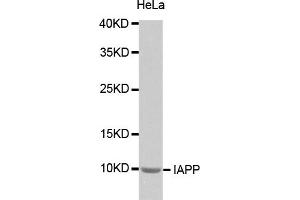 Western blot analysis of extracts of HeLa cells, using IAPP antibody (ABIN2974276). (Amylin/DAP Antikörper)
