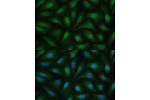 Immunofluorescence (IF) image for anti-Death-Associated Protein Kinase 3 (DAPK3) (AA 1-100) antibody (ABIN7266712)