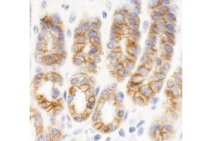 Immunohistochemistry (IHC) image for anti-C2 Calcium Dependent Domain Containing 5 (C2CD5) (AA 375-425) antibody (ABIN7454753) (C2CD5/KIAA0528 Antikörper  (AA 375-425))