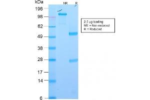 SDS-PAGE Analysis Purified EpCAM Rabbit Recombinant Monoclonal Antibody (EGP40/2571R). (Rekombinanter EpCAM Antikörper  (Extracellular Domain))