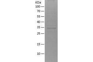 Western Blotting (WB) image for BCL2-Associated X Protein (BAX) (AA 1-110) protein (His-IF2DI Tag) (ABIN7121982) (BAX Protein (AA 1-110) (His-IF2DI Tag))