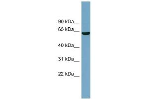 WB Suggested Anti-SLC5A8 Antibody Titration:  0.