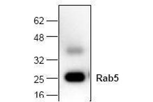 Image no. 1 for anti-RAB5A, Member RAS Oncogene Family (RAB5A) antibody (ABIN127153) (RAB5 Antikörper)