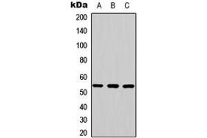 Western blot analysis of JNK2 expression in K562 (A), mouse brain (B), rat brain (C) whole cell lysates. (JNK2 Antikörper  (Center))
